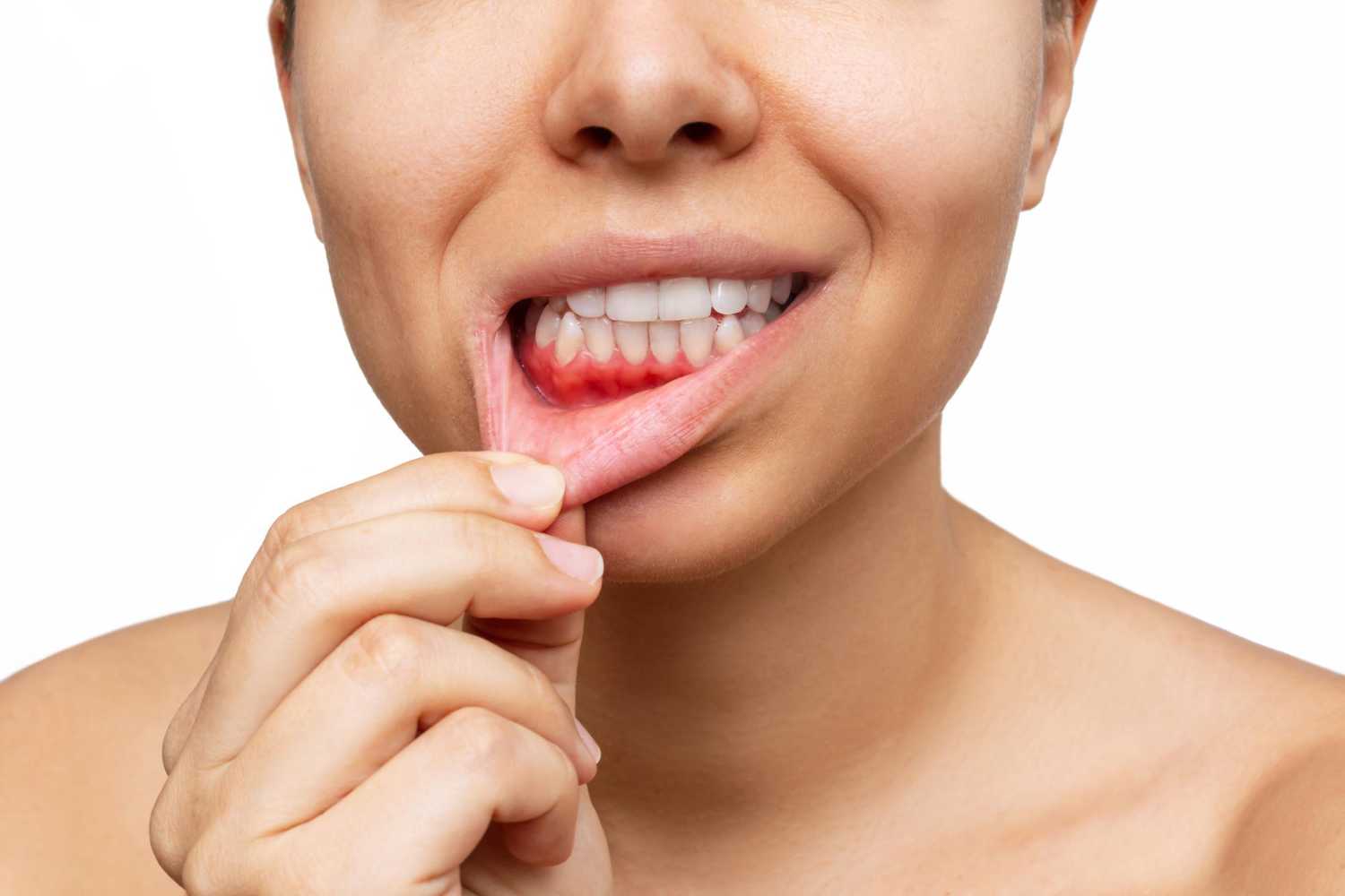 Early Signs of Gum Disease Most People Miss