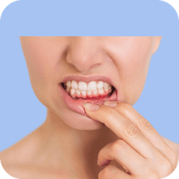 Tooth Sensitivity